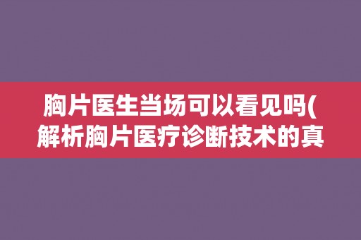 胸片医生当场可以看见吗(解析胸片医疗诊断技术的真相)