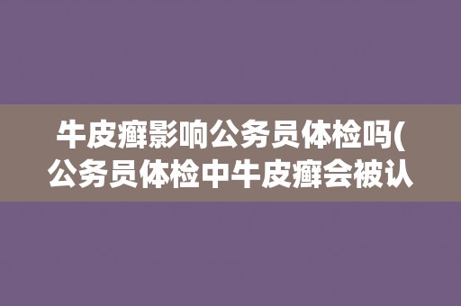牛皮癣影响公务员体检吗(公务员体检中牛皮癣会被认定为不合格吗？)
