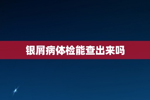 银屑病体检能查出来吗