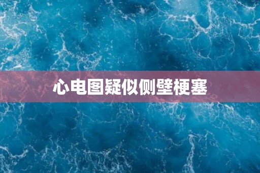心电图疑似侧壁梗塞