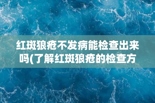 红斑狼疮不发病能检查出来吗(了解红斑狼疮的检查方式和注意事项)