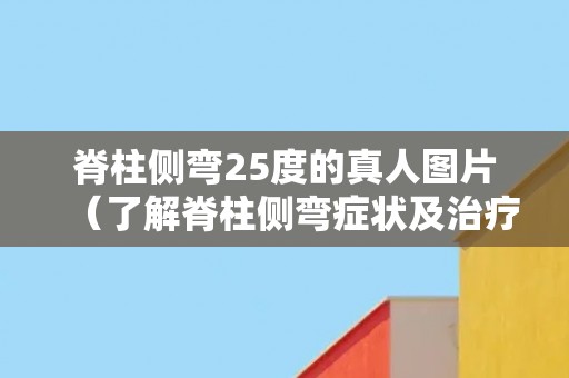 脊柱侧弯25度的真人图片（了解脊柱侧弯症状及治疗方法）