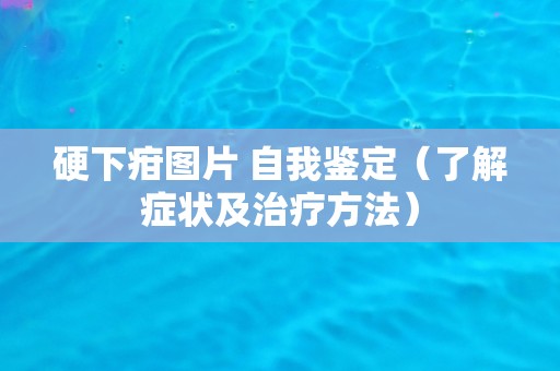 硬下疳图片 自我鉴定(了解症状及治疗方法) 硬下疳图片 自我鉴定(了解症状及治疗方法)